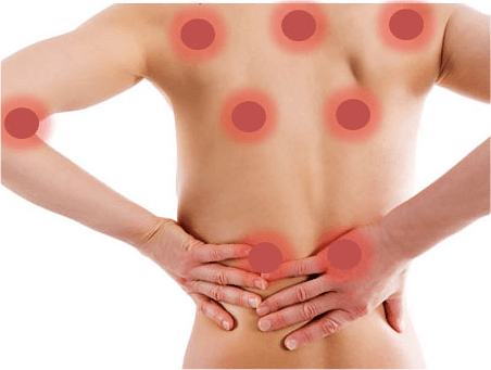 Fibromialgia